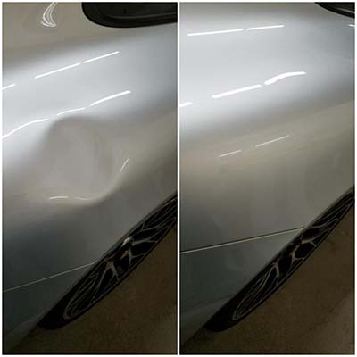Dent3